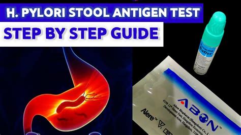 h pylori antigen lab test|h pylori stool sample instructions.